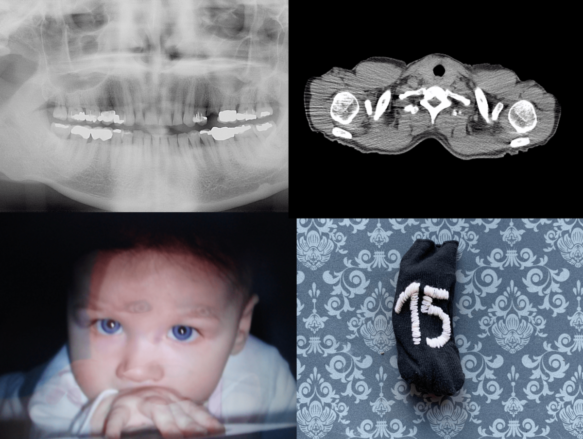 
Warning: Undefined array key 