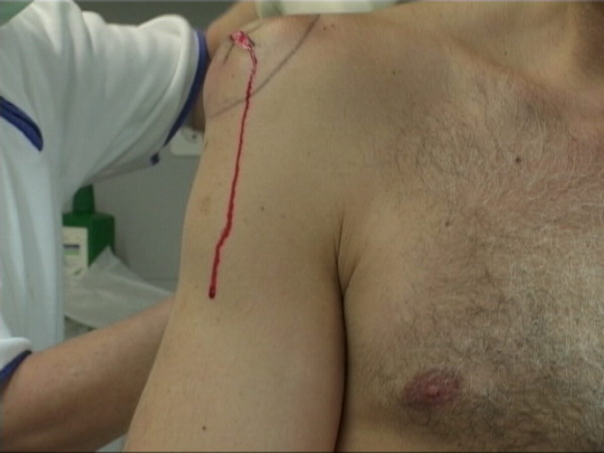 
Warning: Undefined array key 